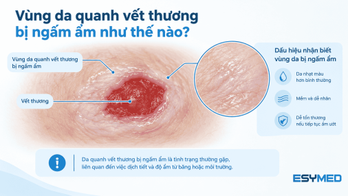 Maceration là gì? Vì sao da quanh vết thương bị trắng và mềm?