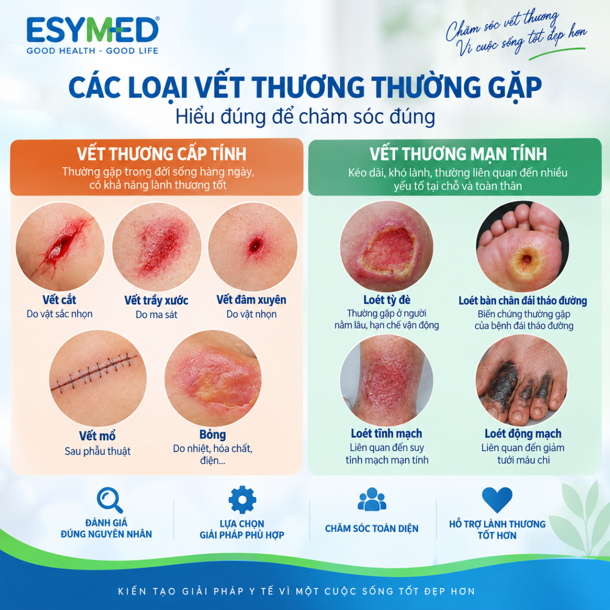 các loại vết thương